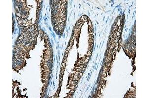 Immunohistochemical staining of paraffin-embedded prostate tissue using anti-DNTTIP1 mouse monoclonal antibody. (DNTTIP1 anticorps)