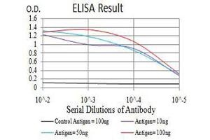 Black line: Control Antigen (100 ng),Purple line: Antigen (10 ng), Blue line: Antigen (50 ng), Red line:Antigen (100 ng)