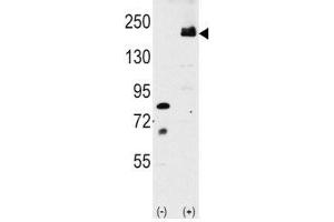 Western blot analysis of LRP6 antibody and 293 cell lysate either nontransfected or transiently transfected with the LRP6 gene. (LRP6 anticorps  (AA 1531-1560))