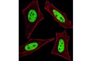Fluorescent image of HeLa cells stained with Cellular Apoptosis Susceptibility Antibody (N-term) (ABIN1882070 and ABIN2838356). (CSE1L anticorps  (N-Term))