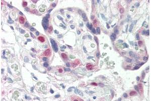 Human Placenta (formalin-fixed, paraffin-embedded) stained with CDK2 antibody ABIN337209 at 5 ug/ml followed by biotinylated anti-mouse IgG secondary antibody ABIN481714, alkaline phosphatase-streptavidin and chromogen. (CDK2 anticorps)