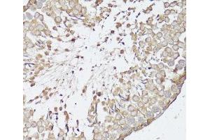Immunohistochemistry of paraffin-embedded Rat testis using OPRK1 Polyclonal Antibody at dilution of 1:100 (40x lens). (OPRK1 anticorps)