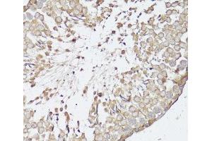 Immunohistochemistry of paraffin-embedded Rat testis using OPRK1 Polyclonal Antibody at dilution of 1:100 (40x lens).