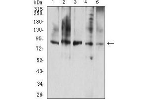 Western blot analysis using CD114 mouse mAb against A431 (1), K562 (2), THP-1 (3), MOLT4 (4), and Jurkat (5) cell lysate.