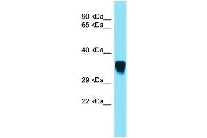 Host: Rabbit  Target Name: Snx15  Sample Tissue: Rat Muscle lysates  Antibody Dilution: 1. (SNX15 anticorps  (C-Term))