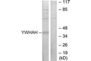 Western blot analysis of extracts from Jurkat cells, using 14-3-3 eta Antibody. (14-3-3 eta anticorps  (AA 51-100))