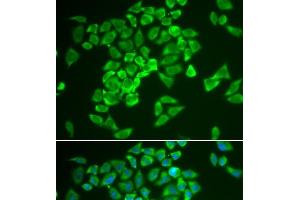 Immunofluorescence analysis of A549 cells using KEAP1 Polyclonal Antibody (KEAP1 anticorps)