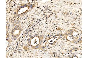 IHC analysis of MLX-interacting protein/MLXIP using anti-MLX-interacting protein/MLXIP antibody (ABIN7602593).