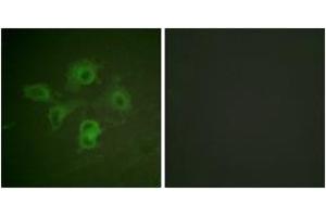 Immunofluorescence analysis of HuvEc cells, using EPHB1/2 (Phospho-Tyr594/604) Antibody. (EPHB1/2 anticorps  (pTyr594))