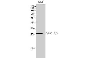 Western Blotting (WB) image for anti-C/EBP delta/epsilon (C-Term) antibody (ABIN3174089) (C/EBP delta/epsilon (C-Term) anticorps)