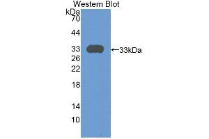 Western blot analysis of the recombinant protein. (Plexin A1 anticorps  (AA 43-300))