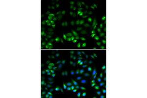 Immunofluorescence analysis of U2OS cells using MANF antibody (ABIN5974212). (MANF anticorps)