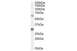 Image no. 1 for anti-Membrane Protein, Palmitoylated 6 (MAGUK P55 Subfamily Member 6) (MPP6) (N-Term) antibody (ABIN374387) (MPP6 anticorps  (N-Term))
