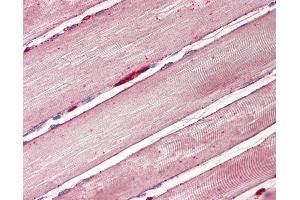 Anti-GLUT4 antibody IHC of human skeletal muscle. (GLUT4 anticorps  (AA 498-509))