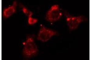 ABIN6277182 staining A549 cells by IF/ICC. (Dynamitin anticorps  (C-Term))