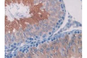 Detection of SDH in Rat Testis Tissue using Polyclonal Antibody to Sorbitol Dehydrogenase (SDH)