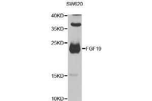 Western blot analysis of extracts of SW620 cells, using FGF19 antibody (ABIN2562584) at 1:1000 dilution. (FGF19 anticorps)