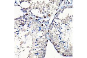 Immunohistochemistry of paraffin-embedded mouse testis using GTPBP4 Rabbit pAb (ABIN1680142, ABIN3019054, ABIN3019055 and ABIN6220689) at dilution of 1:50 (40x lens).