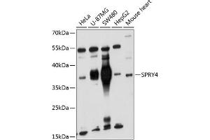 Western blot analysis of extracts of various cell lines, using SPRY4 antibody (ABIN6132548, ABIN6148395, ABIN6148396 and ABIN6221865) at 1:1000 dilution.