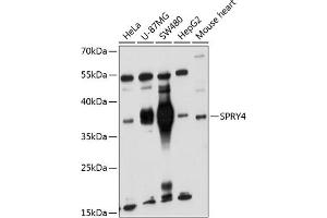 Western blot analysis of extracts of various cell lines, using SPRY4 antibody (ABIN6132548, ABIN6148395, ABIN6148396 and ABIN6221865) at 1:1000 dilution. (SPRY4 anticorps  (AA 30-210))