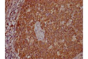 IHC image of ABIN7166916 diluted at 1:400 and staining in paraffin-embedded human tonsil tissue performed on a Leica BondTM system. (PKM anticorps  (AA 2-531))