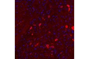 Immunofluorescentanalysis of paraffin embedded mouse cerebellum using Nrg4 (ABIN7074805) at dilution of 1: 300 (Neuregulin 4 anticorps)