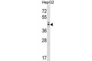 Western Blotting (WB) image for anti-Neuroguidin, EIF4E Binding Protein (NGDN) antibody (ABIN2998327) (NGDN anticorps)