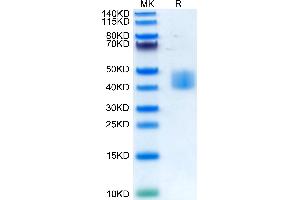 Human MSLN/Mesothelin on Tris-Bis PAGE under reduced condition. (Mesothelin Protein (MSLN) (AA 296-580) (His-Avi Tag))