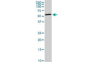 HDAC1 monoclonal antibody (M02), clone 3E1. (HDAC1 anticorps  (AA 1-482))