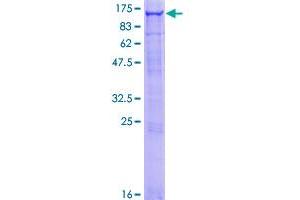 Image no. 1 for Oculocerebrorenal Syndrome of Lowe (OCRL) (AA 1-893) protein (GST tag) (ABIN1313326)