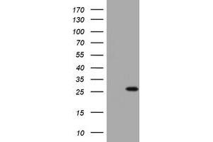 Image no. 1 for anti-BCL2/adenovirus E1B 19kDa Interacting Protein 1 (BNIP1) (AA 1-199) antibody (ABIN1490606) (BNIP1 anticorps  (AA 1-199))