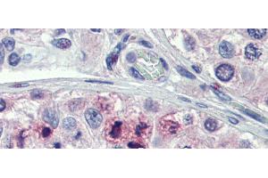 Rabbit Anti-STAT5B Antibody Catalog Number: arp39000 Paraffin Embedded Tissue: Human Testis Antibody Concentration: 5 ug/ml