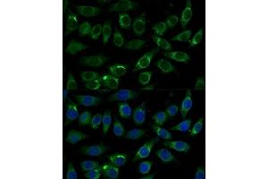 Immunofluorescence analysis of L929 cells using  Polyclonal Antibody  at dilution of 1:100 (40x lens).