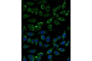 Immunofluorescence analysis of L929 cells using  Polyclonal Antibody  at dilution of 1:100 (40x lens). (ALDH3A2 anticorps  (AA 250-320))