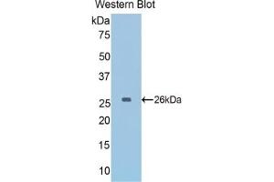 Detection of Recombinant GAPDH, Mouse using Polyclonal Antibody to Glyceraldehyde-3-Phosphate Dehydrogenase (GAPDH)