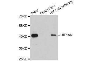 Immunoprecipitation analysis of 200 μg extracts of 293T cells using 1 μg HIF1AN antibody (ABIN5973179). (HIF1AN anticorps)