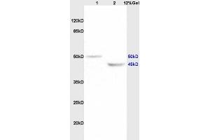 Lane 1: rat brain lysates Lane 2: rat heart lysates probed with Anti KCNN4 Polyclonal Antibody, Unconjugated (ABIN719786) at 1:200 in 4 °C.