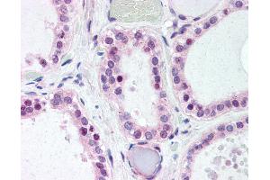 Anti-WNT4 antibody IHC of human thyroid.