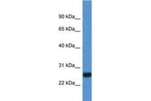 Image no. 1 for anti-Interleukin 27 (IL27) (C-Term) antibody (ABIN6749775) (IL-27 anticorps  (C-Term))