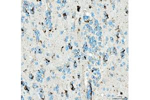 IHC analysis of SIAE using anti-SIAE antibody (ABIN7600774). (SIAE anticorps  (AA 230-523))