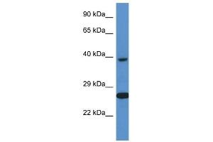 Western Blot showing XRCC3 antibody used at a concentration of 1 ug/ml against ACHN Cell Lysate (XRCC3 anticorps  (C-Term))
