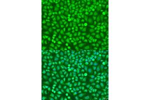 Immunofluorescence analysis of U2OS cells using HOXB5 antibody (ABIN7267769) at dilution of 1:100. (HOXB5 anticorps  (AA 1-170))