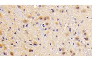 Detection of XRN1 in Rat Cerebrum Tissue using Polyclonal Antibody to 5'-3'Exoribonuclease 1 (XRN1)