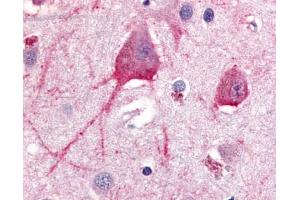 Anti-TRH Receptor antibody IHC of human brain, neurons and glia.