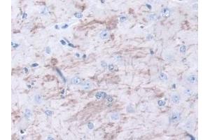 Detection of METRN in Mouse Cerebrum Tissue using Polyclonal Antibody to Meteorin (METRN)