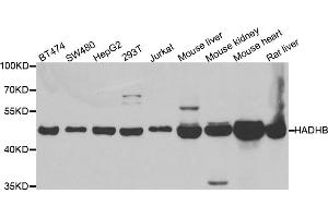 Western blot analysis of extracts of various cell lines, using HADHB antibody (ABIN5973344) at 1/1000 dilution. (HADHB anticorps)