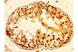 IHC image of ABIN7171412 diluted at 1:800 and staining in paraffin-embedded human testis tissue performed on a Leica BondTM system. (TCP1 alpha/CCTA anticorps  (AA 406-506))
