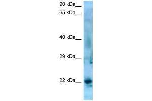 WB Suggested Anti-SSX5 Antibody   Titration: 1. (SSX5 anticorps  (C-Term))