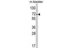 Western Blotting (WB) image for anti-Protein tyrosine Phosphatase, Non-Receptor Type 11 (PTPN11) antibody (ABIN3002836)
