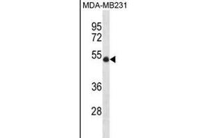 UBR7 Antibody (N-term) (ABIN1881973 and ABIN2838438) western blot analysis in MDA-M cell line lysates (35 μg/lane). (UBR7 anticorps  (N-Term))